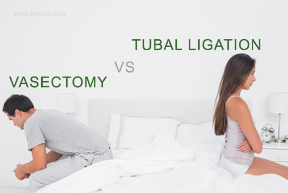 Vasectomy vs. Tubal Ligation
