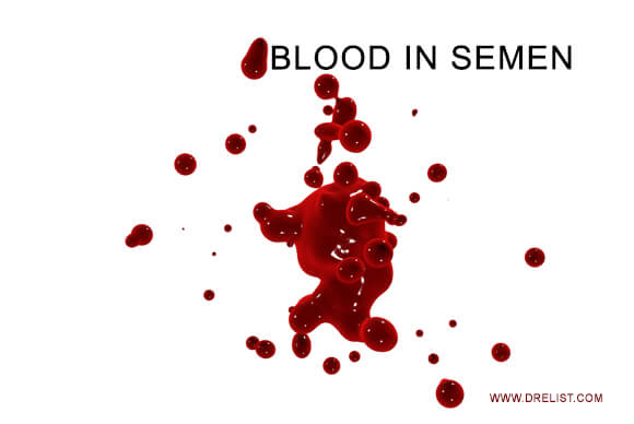 Blood in Semen