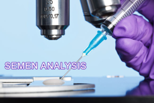 Semen Analysis Image