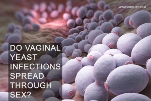 Do Vaginal Yeast Infections Spread Through Sex? image