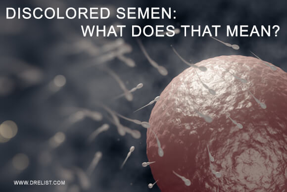 Discolored Semen: What Does That Mean?