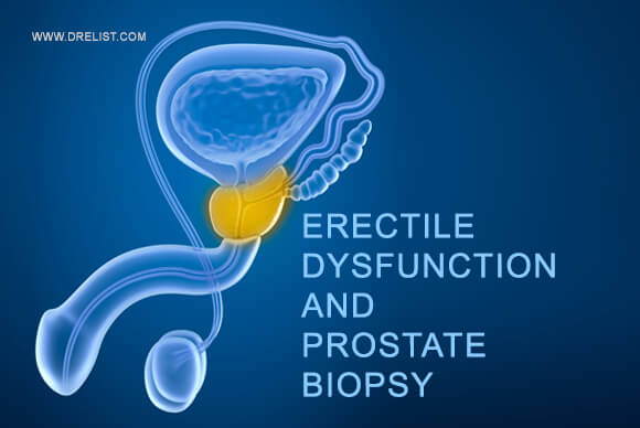 Erectile Dysfunction and Prostate Biopsy