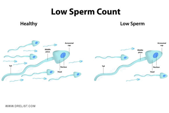 Low Sperm Count