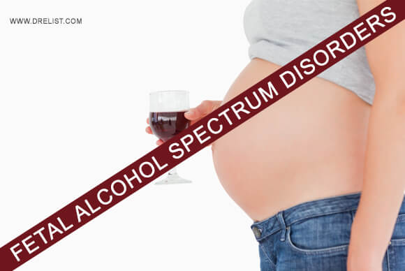 Fetal Alcohol Spectrum Disorders Or FASD
