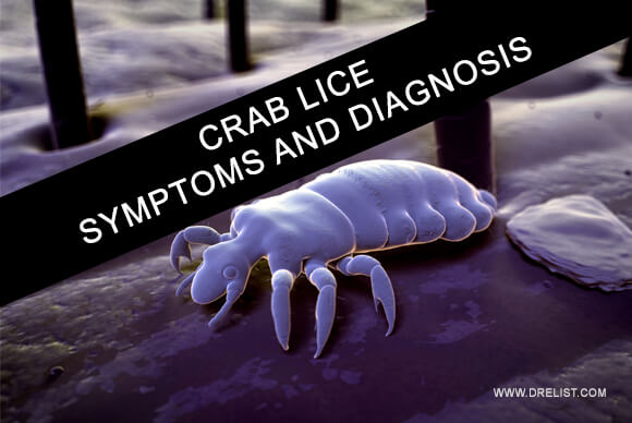 Crab Lice Symptoms And Diagnosis