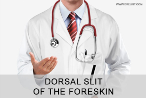 Dorsal Slit of the Foreskin Image