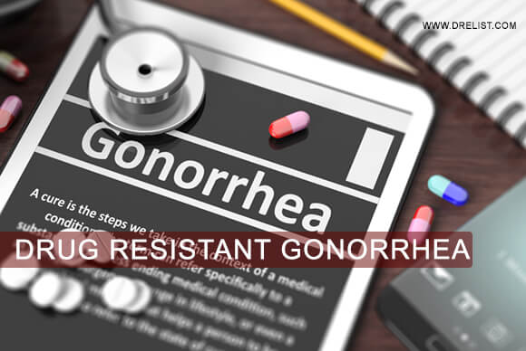 Drug Resistant Gonorrhea – What Should You Know About It?