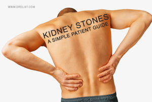 Kidney Stones A Simple Patient Guide image