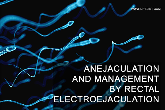 Anejaculation And Management By Rectal Electroejaculation