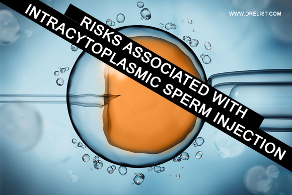 Risks Associated With Intracytoplasmic Sperm Injection