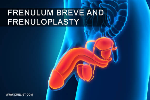 Frenulum Breve And Frenuloplasty – What Should You Know About It?