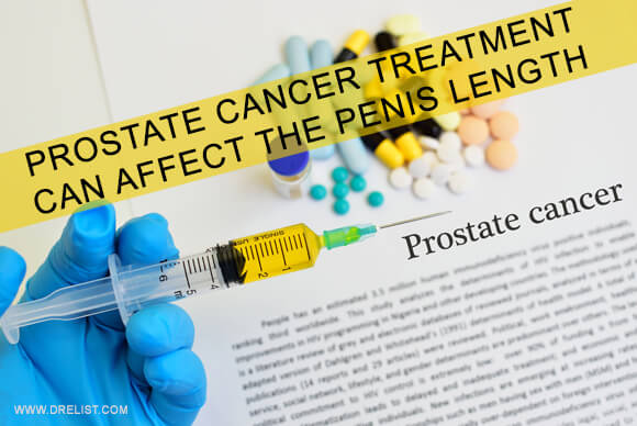 Prostate Cancer Treatment Can Affect The Penis Length