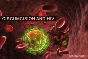 Circumcision And HIV image