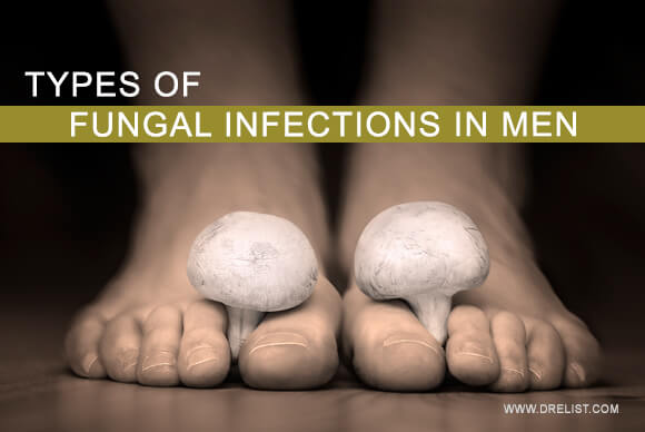 Types Of Fungal Infections In Men