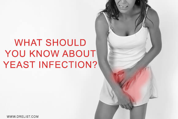 What Should You Know About Yeast Infection?