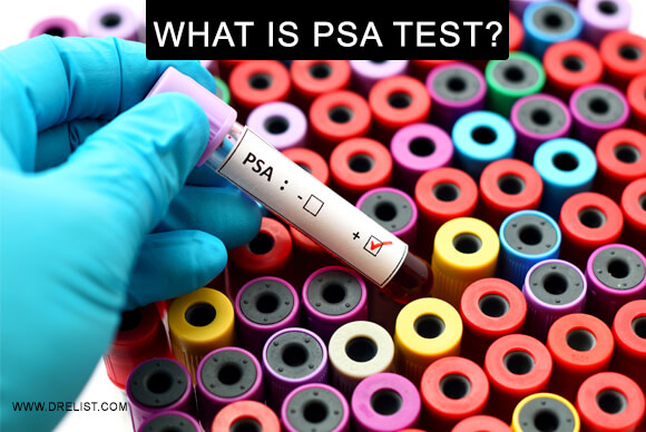 What Is PSA Test?
