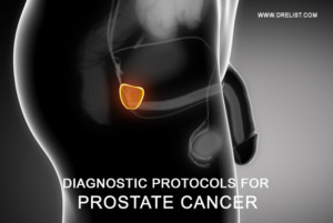 Diagnostic Protocols For Prostate Cancer image