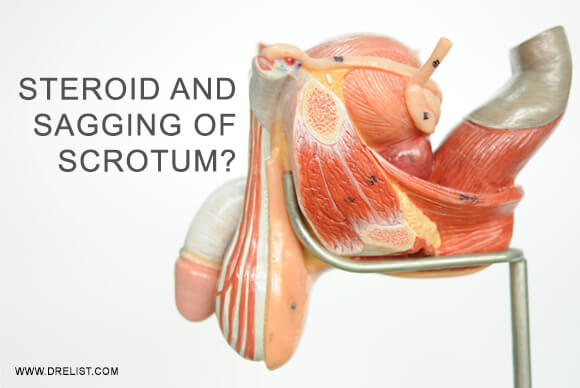 How Steroid Use Leads To Sagging Of Scrotum?