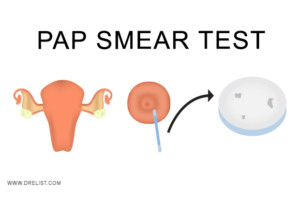 Pap Smear Test Image