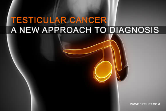 Testicular Cancer – A New Approach To Diagnosis