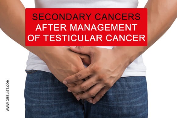 Secondary Cancers After Management Of Testicular Cancer