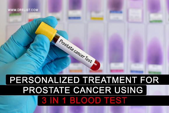 Personalized Treatment For Prostate Cancer Using 3 In 1 Blood Test