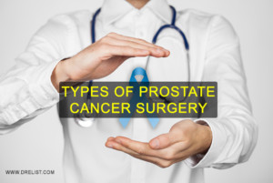 Types Of Prostate Cancer Surgery Image