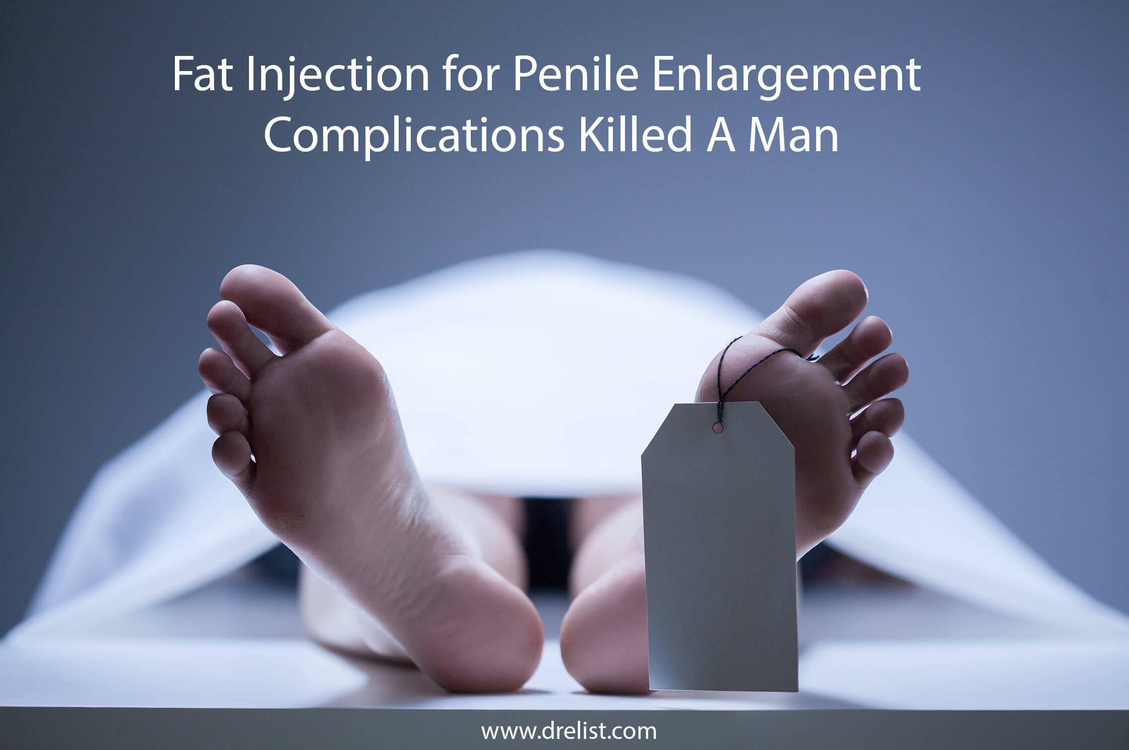 Fat Injection for Penile Enlargement Complication Killed A Man
