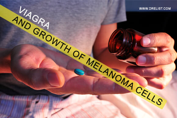 Viagra And Growth Of Melanoma Cells