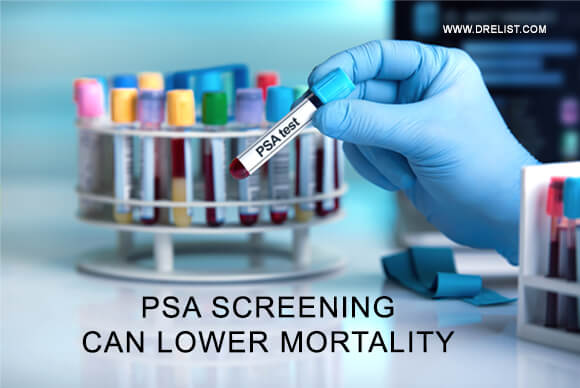 PSA Screening Can Lower Mortality