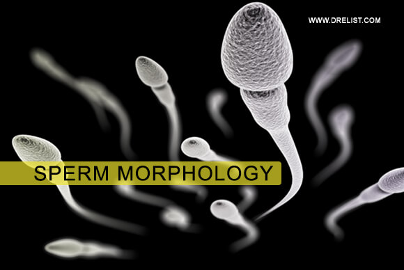 Sperm Morphology - Tests And Results