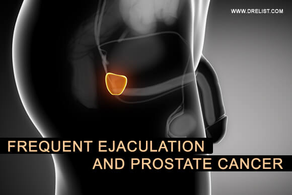 Frequent Ejaculation And Prostate Cancer: What's The Link?