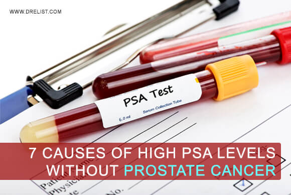 7 Causes Of High PSA Levels Without Prostate Cancer