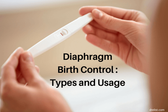Diaphragm Birth Control