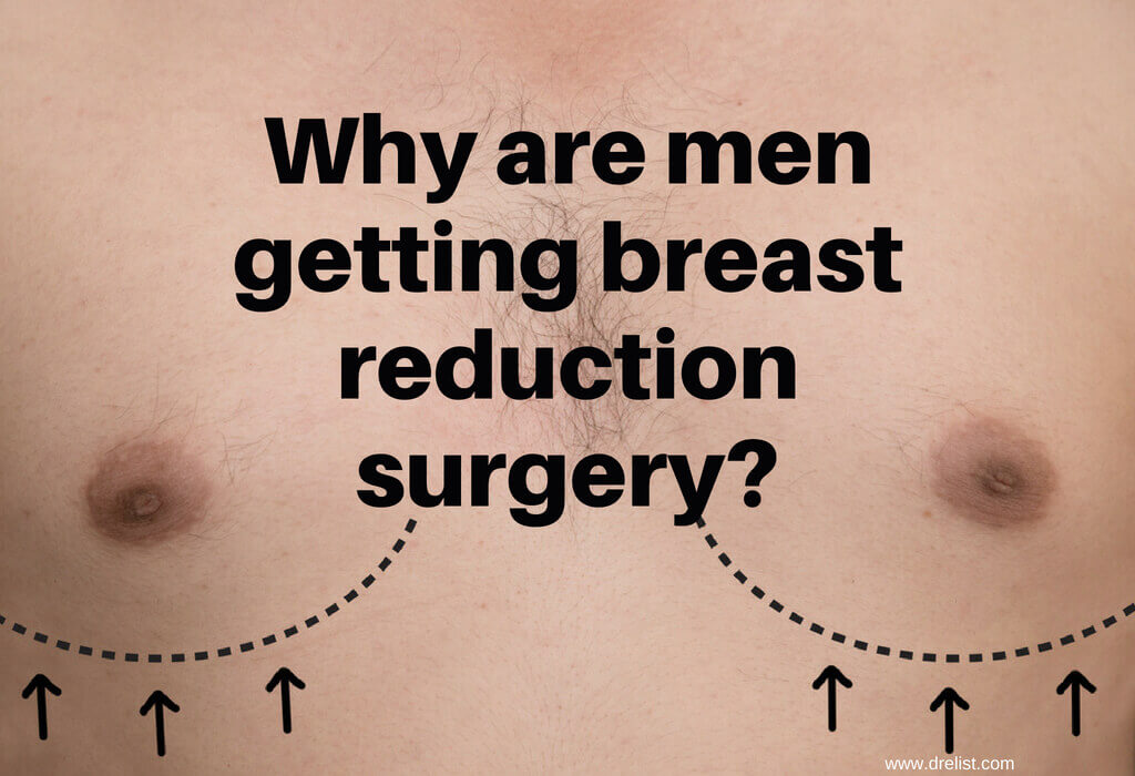 Why are men getting breast reduction surgery?