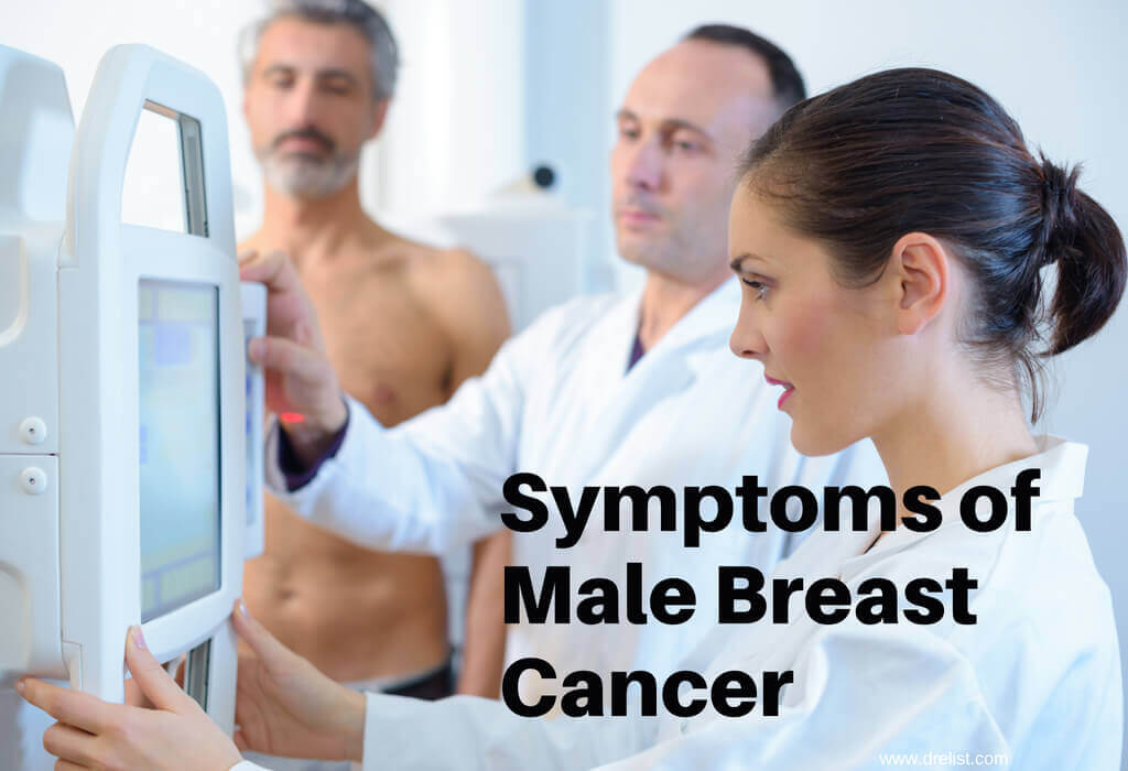 Symptoms of Male Breast Cancer