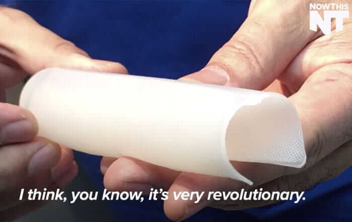 NOWTHIS: PENIS IMPLANT