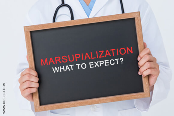 Marsupialization - What To Expect?
