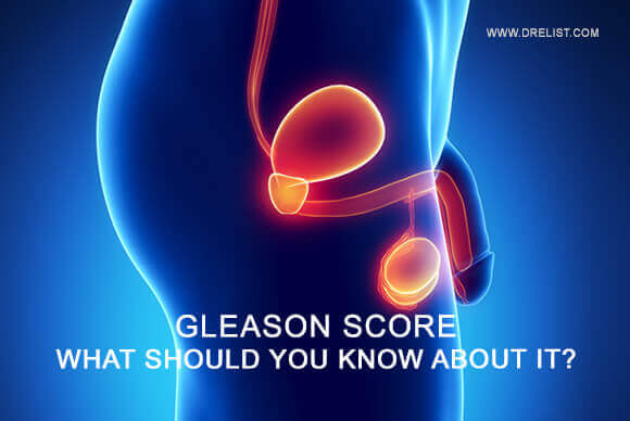 Gleason Score – What Should You Know About It?
