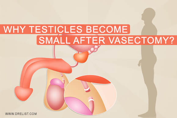 Why Do Testicles Become Small After Vasectomy?