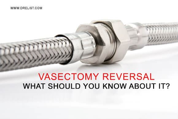Vasectomy Reversal – What Should You Know About It?