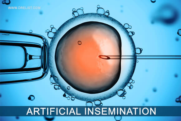 Artificial Insemination