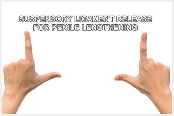 Suspensory Ligament Release for Penile Lengthening