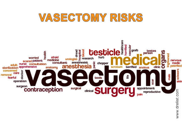 Vasectomy Risks and Requirements