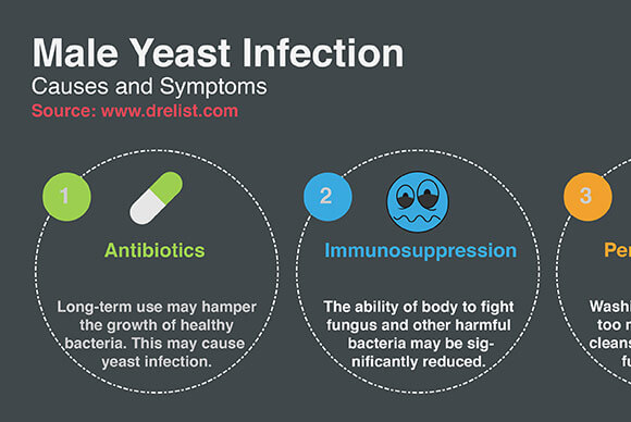 Male Yeast Infection Symptoms in a Nutshell