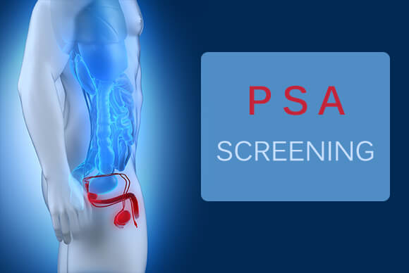 PSA Screening Affected by Age|Race