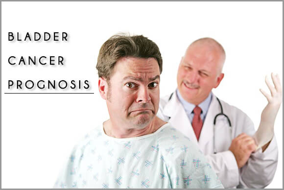 Bladder Cancer Prognosis | How to Manage or Prevent it?