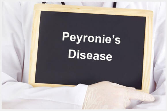 Peyronie's disease