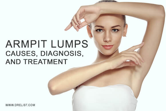 Armpit Lumps Causes, Diagnosis, And Treatment