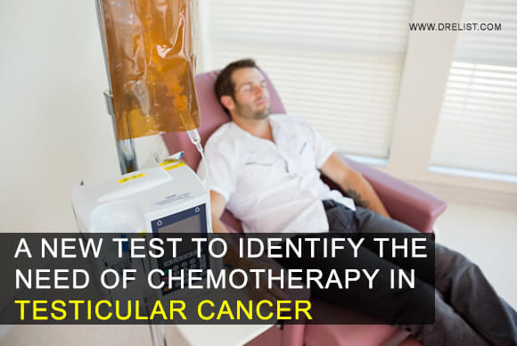 A New Test To Identify The Need Of Chemotherapy In Testicular Cancer